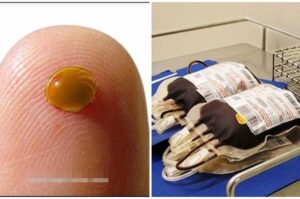 Kisah Unik, Orang dengan Golongan Darah Langka Ini Cuma Sendirian di Bumi