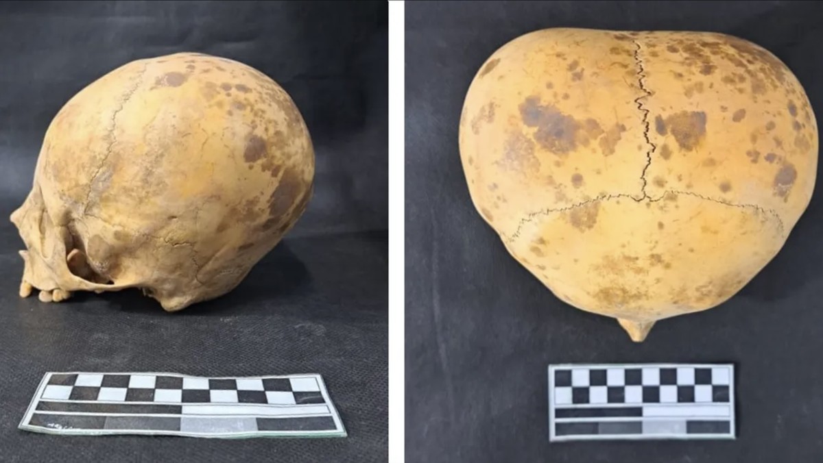 Mitos Tengkorak Aneh Mirip Alien, Fakta yang Bikin Tercengang!