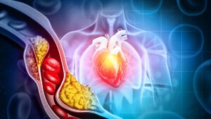 Ngeri! Mikroplastik Ternyata Ada di Sekitar Kita, Bahkan Sudah Masuk ke Tubuh!